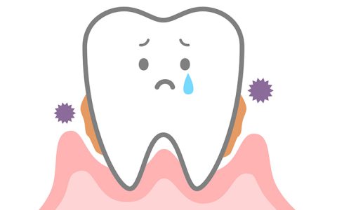 こわ～い根面の虫歯にご用心！