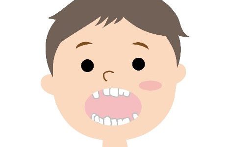 歯並びは全身の不調に影響がある⁉
